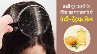 डैंड्रफ से छुटकारा पाने के लिए घर पर बनाएं ये Anti-Dandruff Hair Oil, दूर होगी समस्या