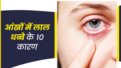आंखों में लाल धब्बों के पीछे हो सकते हैं ये 10 कारण, जानें डॉक्टर के पास कब जाएं