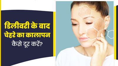 डिलीवरी के बाद चेहरे का कालापन कैसे दूर करें? जानें 6 उपाय
