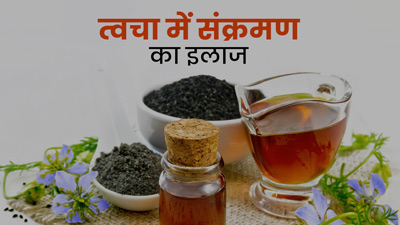 स्किन इंफेक्शन को दूर करता है कलौंजी का तेल, जानें इस्‍तेमाल का सही तरीका 