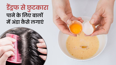 डैंड्रफ से छुटकारा पाने के लिए इन 3 तरीकों से इस्तेमाल करें अंडा