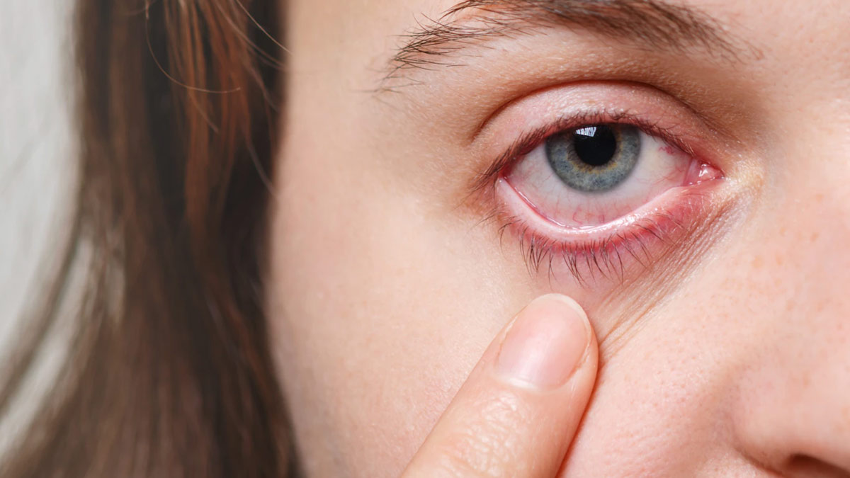 Why is there a cavity in the eye? Learn its causes and prevention tips