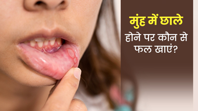 मुंह के छालों से पाना है छुटकारा तो खाएं ये 5 फ्रूट्स, मिलेगा फायदा
