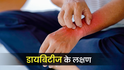 डायब‍िटीज का संकेत हो सकते हैं त्‍वचा में नजर आने वाले ये 5 लक्षण, न करें नजरअंदाज