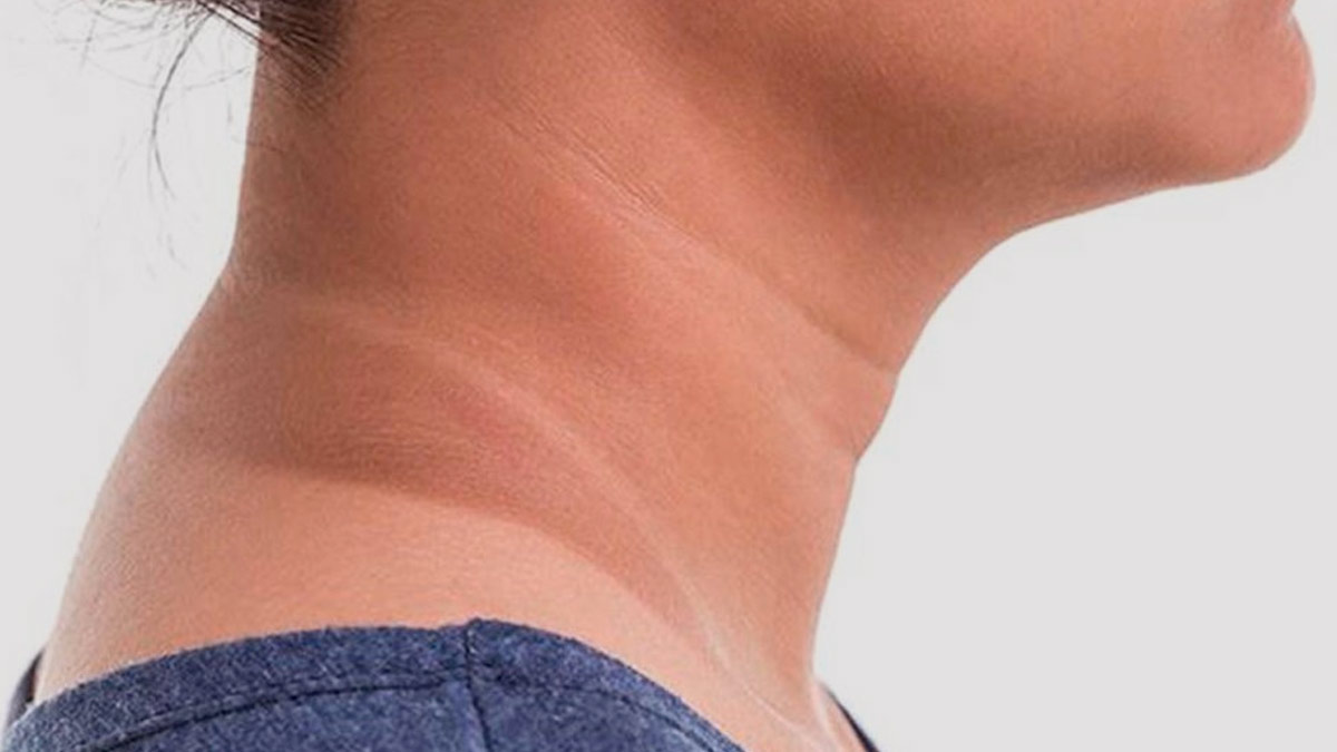black neck symptoms