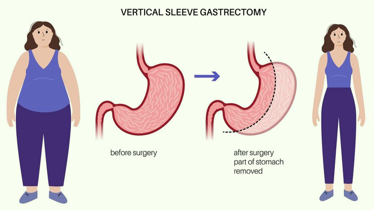 how-does-early-detection-play-a-role-in-stomach-cancer-symptoms-to