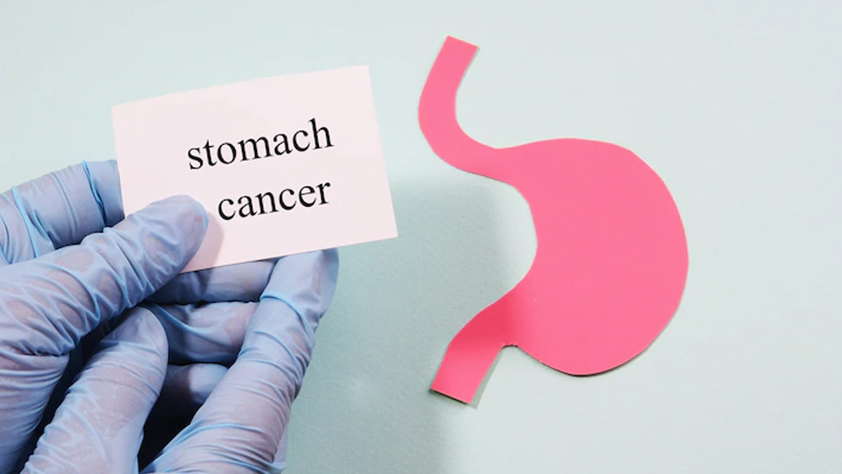 How Does Early Detection Play a Role In Stomach Cancer & Symptoms To Watch Out For