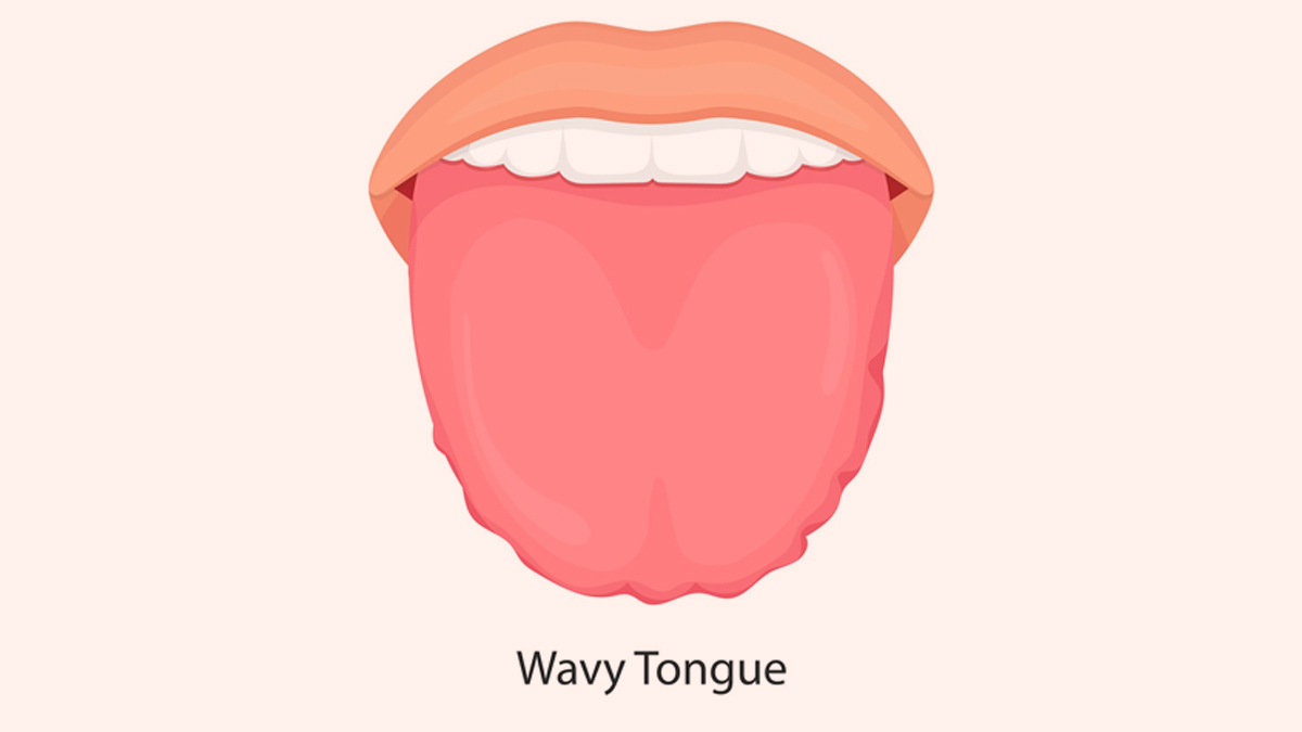 Signs Your Tongue Gives About Your Health