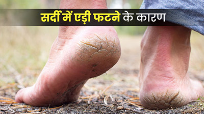 सर्दियों में एड़ी फटने के हो सकते हैं ये 6 कारण