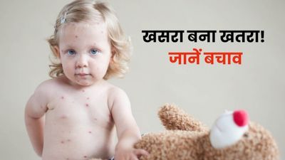 भारत में इस साल तेजी से बढ़े खसरा के मामले, हो रही बच्चों की मौत, WHO ने जताई चिंता