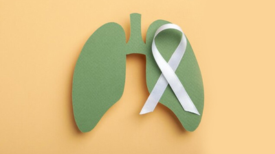Alarming Rise In Lung Cancer Cases Among Youngster...