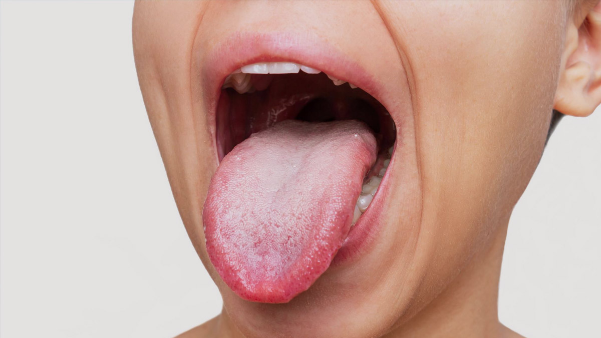 Unhealthy-Gut-Symptoms