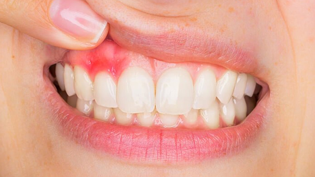 paan leaves for oral health