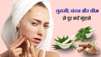 नीम, तुलसी और चंदन से करें मुंहासों की समस्या को दूर, जानें कैसे करें उपयोग