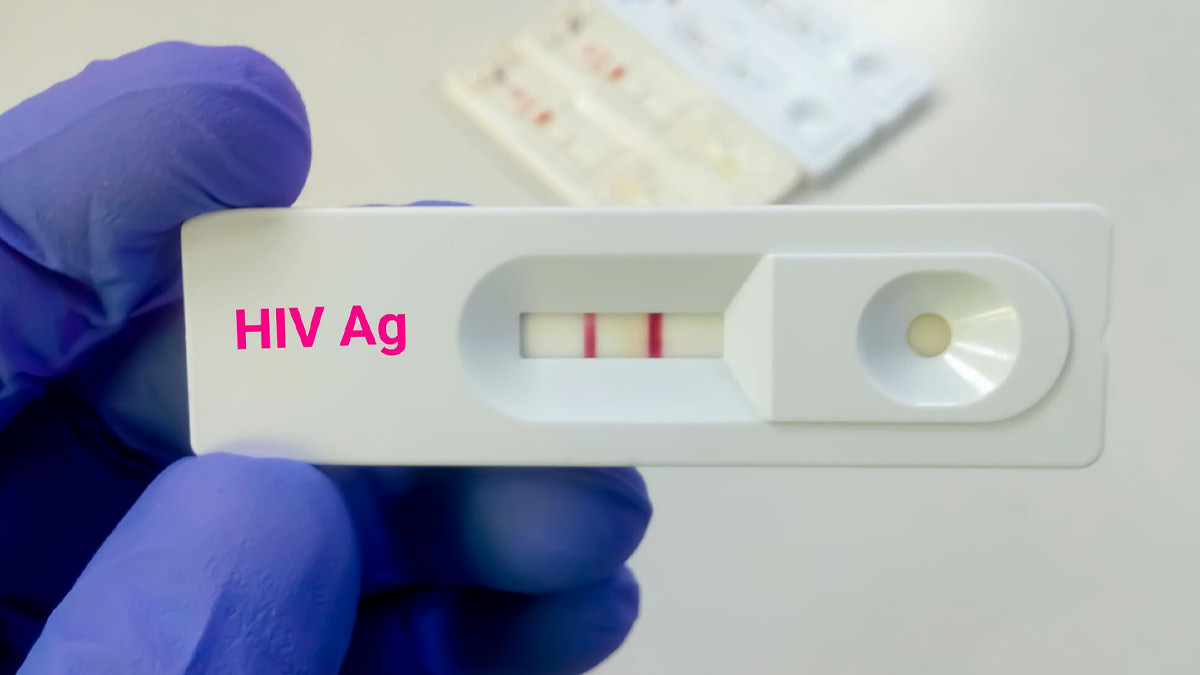 World AIDS Day 2022: 5 Bizarre Myths About HIV That Needs To Be Busted ...