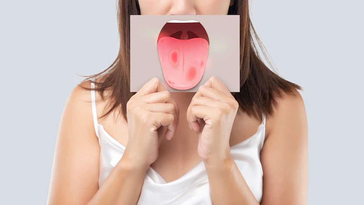 Burning Mouth Syndrome: Symptoms, Causes, & Treatment