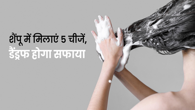 डैंड्रफ से छुटकारा पाने के लिए शैंपू में मिलाएं ये 5 चीजें, दूर होंगी कई समस्याएं