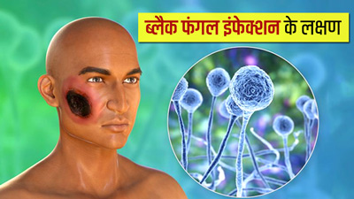 ब्लैक फंगल इंफेक्शन के होते हैं ये 6 लक्षण, एंटीबायोटिक लेने वाले रहें सावधान