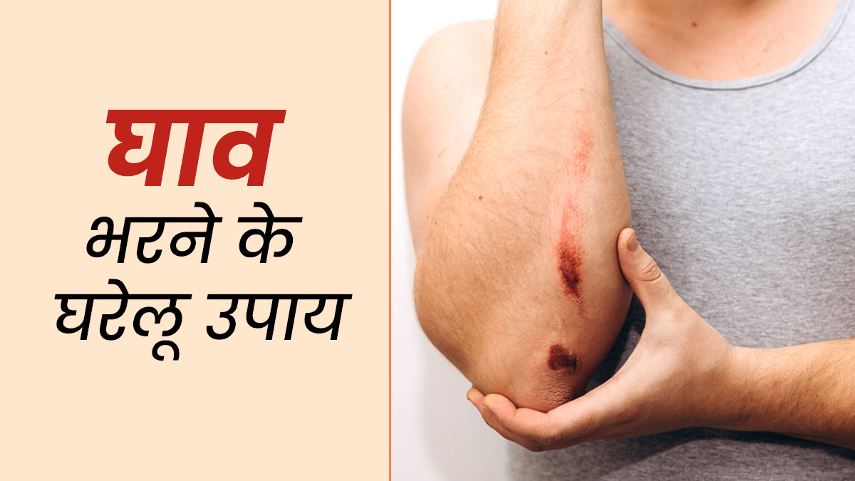 5-home-remedies-to-heal-wounds