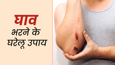 घाव भरने में मदद करेंगे ये 5 घरेलू उपाय