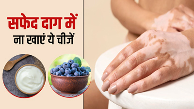 सफेद दाग के रोगियों को नहीं खानी चाहिए ये चीजें, बढ़ सकती है समस्या