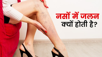 नसों में जलन क्यों होती है?, जानें 5 कारण