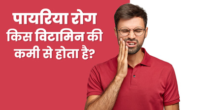 पायरिया रोग किस विटामिन की कमी से होता है? जानें बचाव