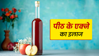 पीठ पर हो रहे हैं मुंहासे? ऐसे इस्‍तेमाल करें सेब का स‍िरका 