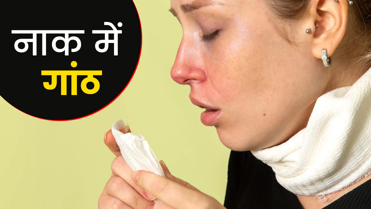 नाक में गांठ किन कारणों से हो सकती है?  जानें इसके लक्षण