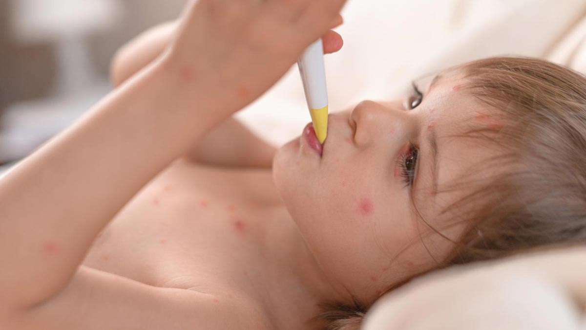 Respiratory Syncytial Virus Disease in Hindi