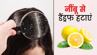 बालों में डैंड्रफ से हैं परेशान? नींबू को इन 3 तरह के इस्तेमाल करके दूर भगाएं रूसी