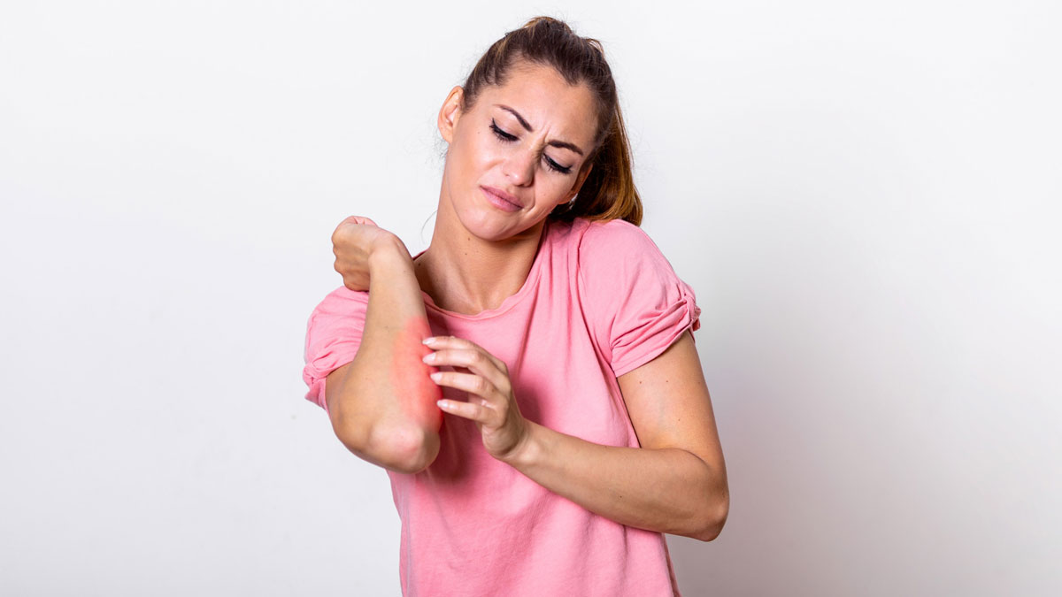 how-to-get-rid-of-skin-allergies-onlymyhealth