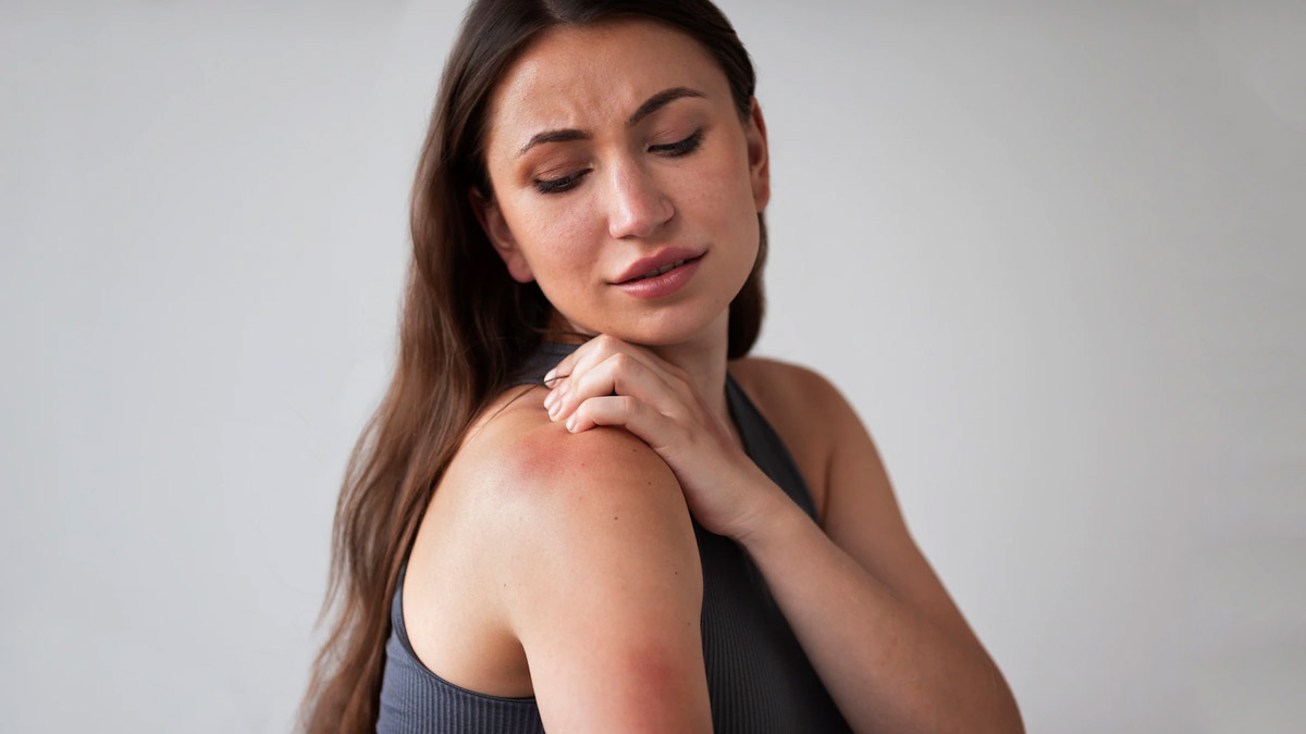 how-to-get-rid-of-skin-allergies-onlymyhealth