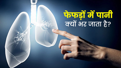 फेफड़ों में पानी क्यों भर जाता है? जानें 4 कारण