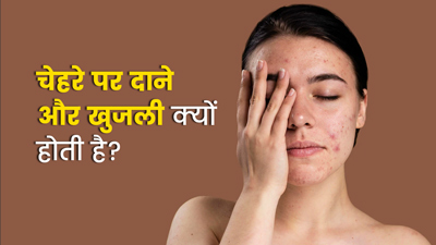 चेहरे पर दाने और खुजली क्यों होती है? जानें 5 कारण