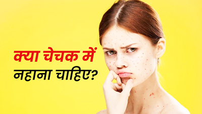 चेचक (छोटी माता) निकलने पर क्या नहीं नहाना चाहिए? जानें डॉक्‍टर की राय