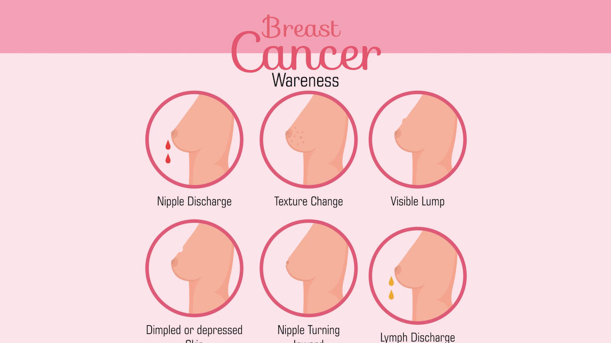 how-to-check-for-breast-cancer-at-home-onlymyhealth