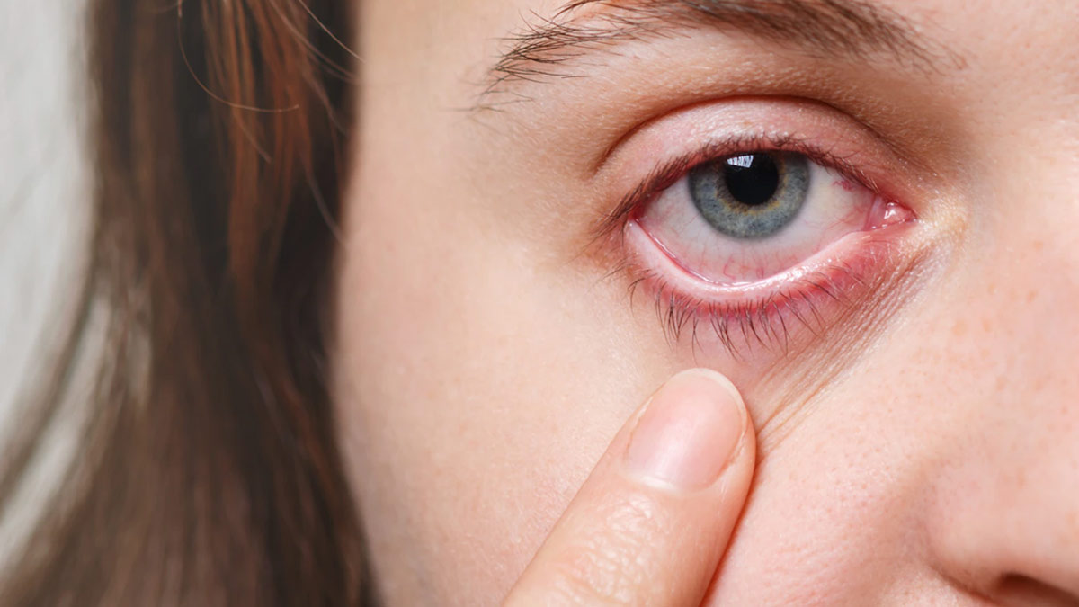 Do Your Eyes Lack Tears? Dry Eye Disease Can Be A Reason