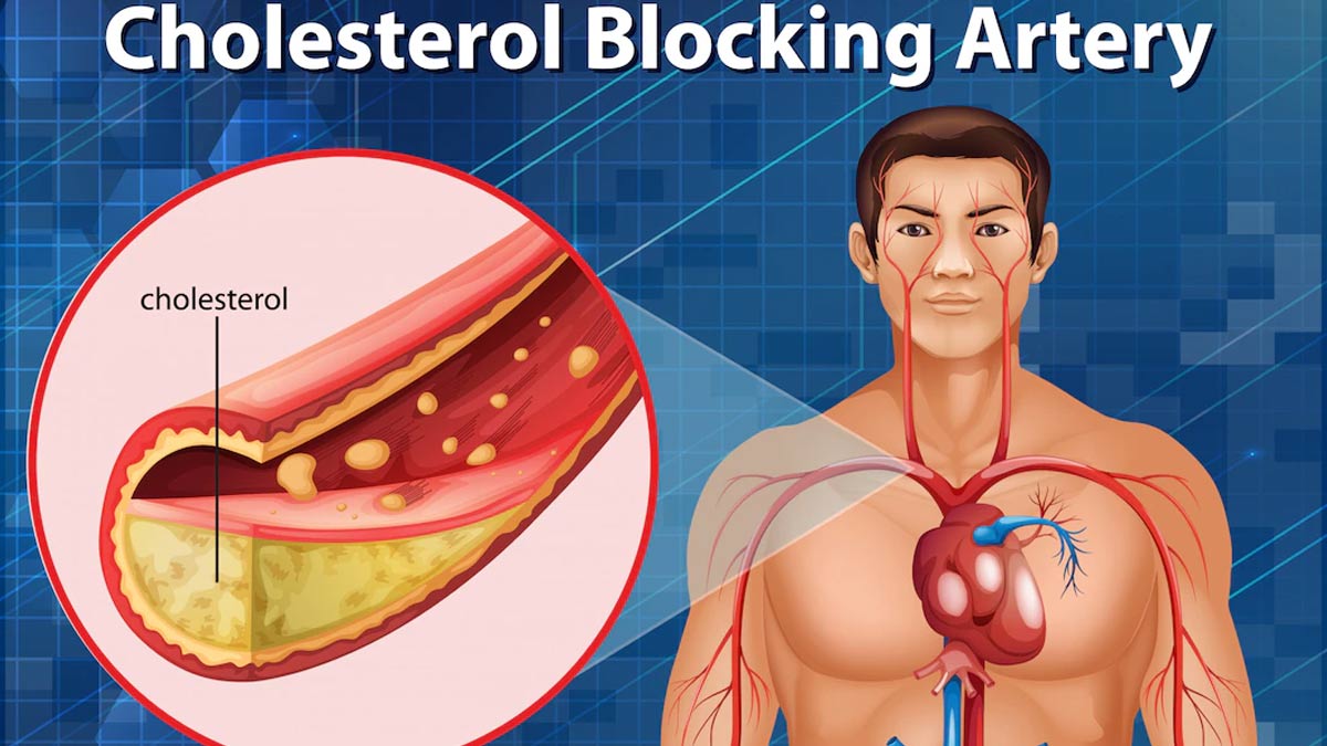 Fenugreek Seeds Benefits For Lowering Cholesterol