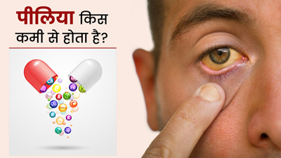 पीलिया किस विटामिन की कमी से होता है? जानें इनके स्रोत