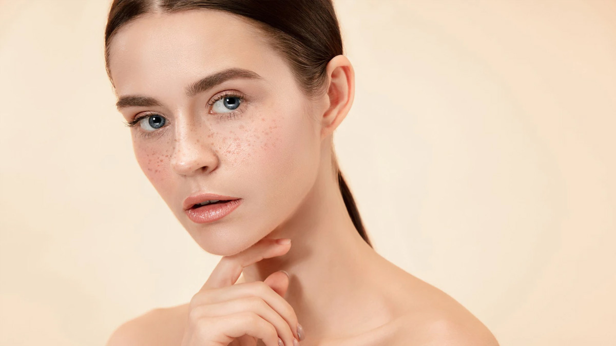 imported/images/2022/October/31_Oct_2022/Lemon-For-Freckles.jpg
