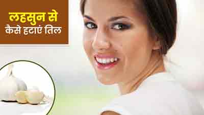 लहसुन से हटाएं तिल, इन 4 तरीकों से करें इस्तेमाल