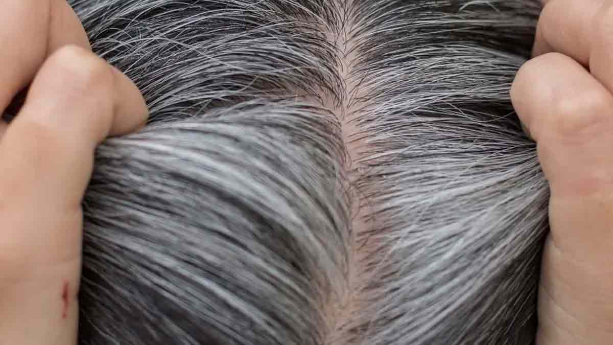 grey hair problems 