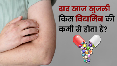 दाद, खाज, खुजली किस विटामिन की कमी से होता है? जानें इसके स्रोत