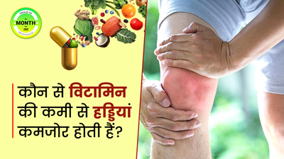 Weak Bones: कौन से विटामिन की कमी से हड्डियां कमजोर होती हैं? 