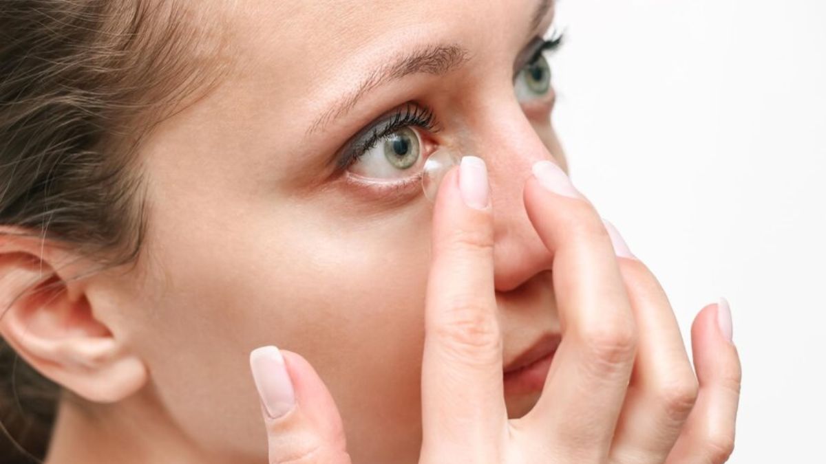 आंखों के अंदर सफेद लम्प्स क्यों पड़ते हैं? डॉक्टर से जानें कारण और बचाव