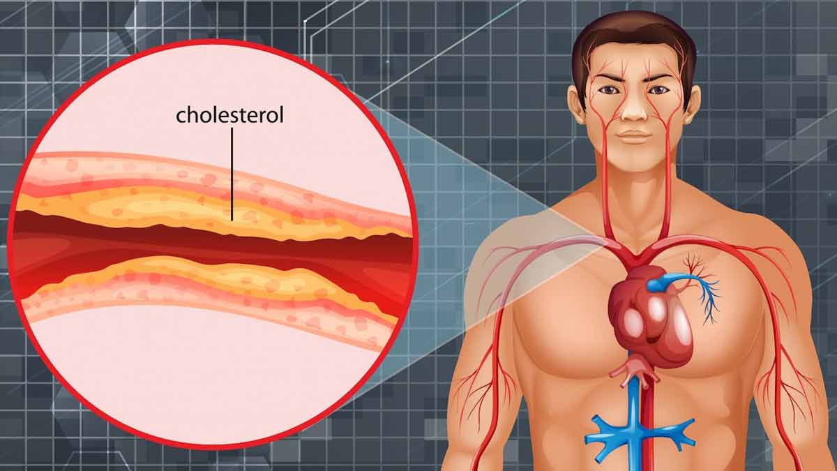 Yoga To Increase Hdl Cholesterol In Hindi