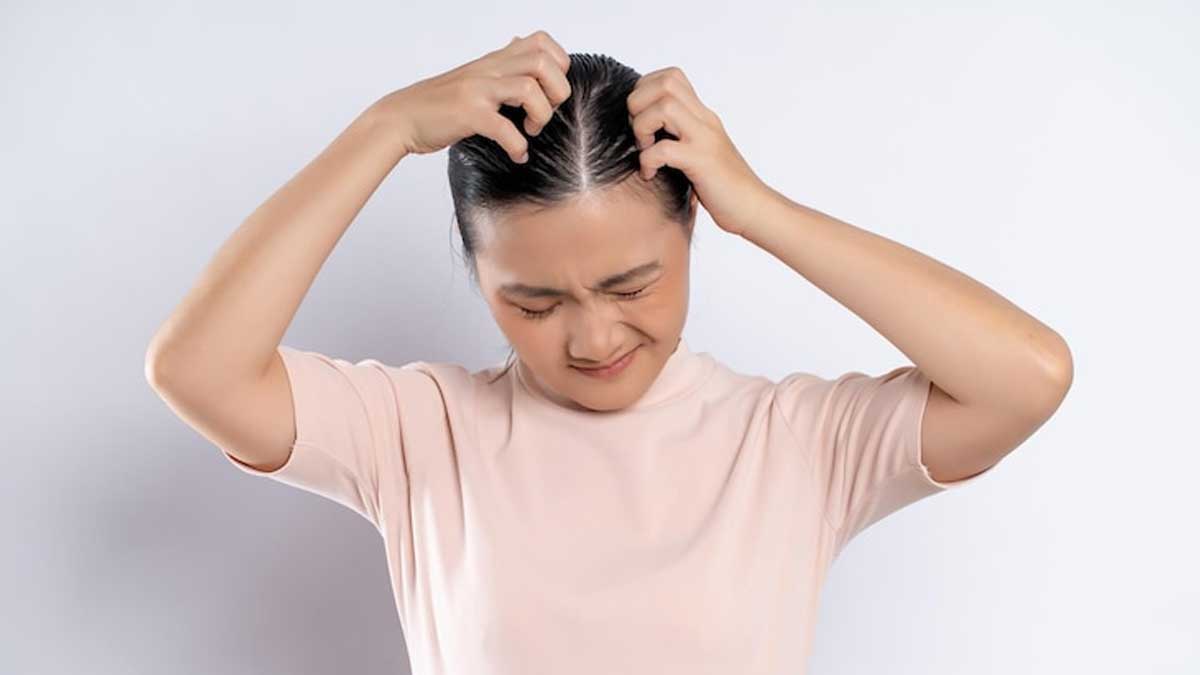 head itching treatment 