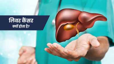 इन कारणों से हो सकते हैं आप भी लिवर कैंसर का शिकार, जानें बचाव 