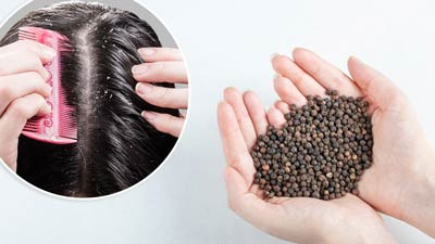 डैंड्रफ दूर करती है काली मिर्च, जानें प्रयोग के 5 तरीके